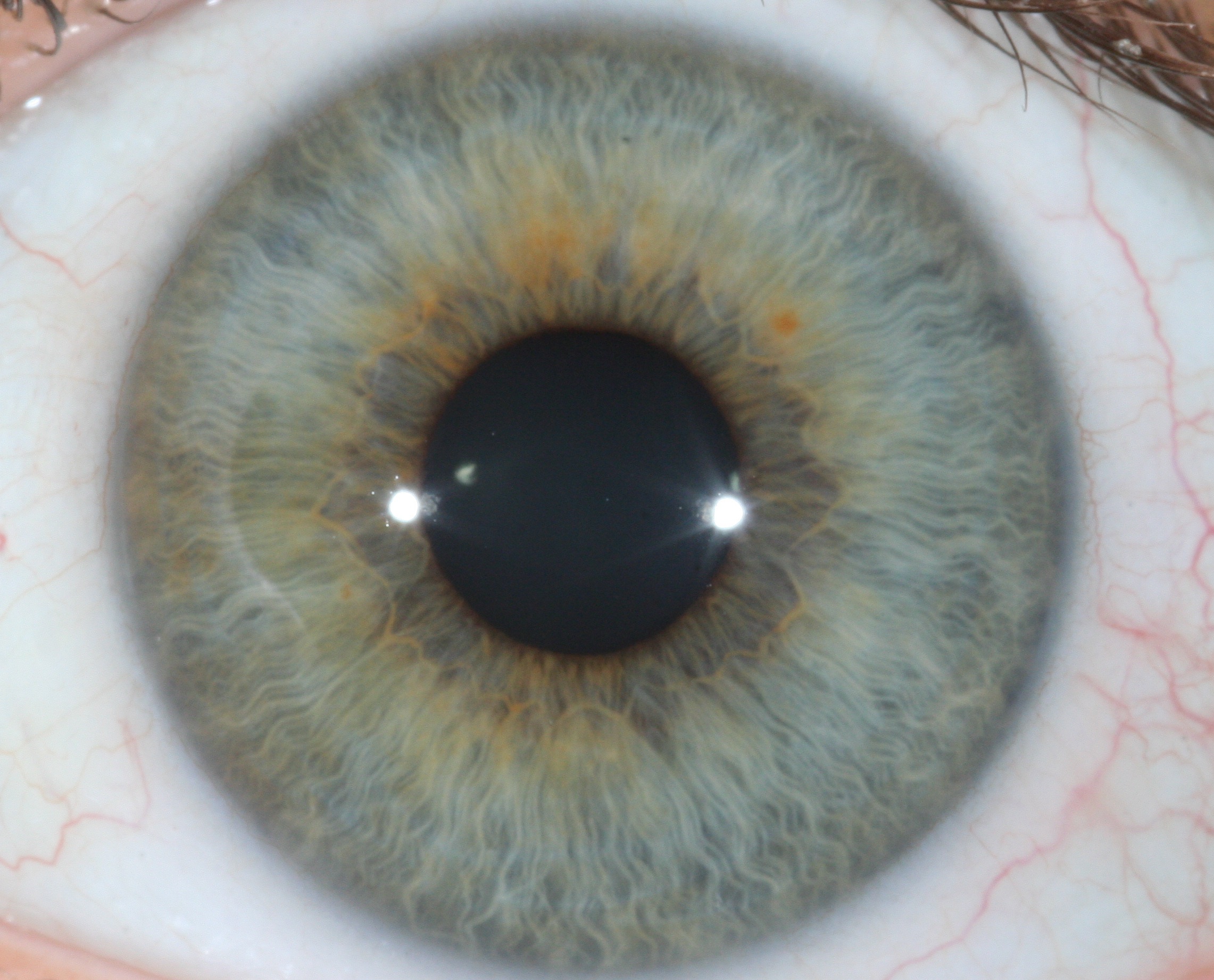 Iridology